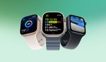 SmartxAppleWatch1